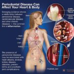 The Silent Saboteur: Understanding Periodontitis and Its Impact on Oral Health