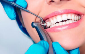 teeth cleaning las vegas